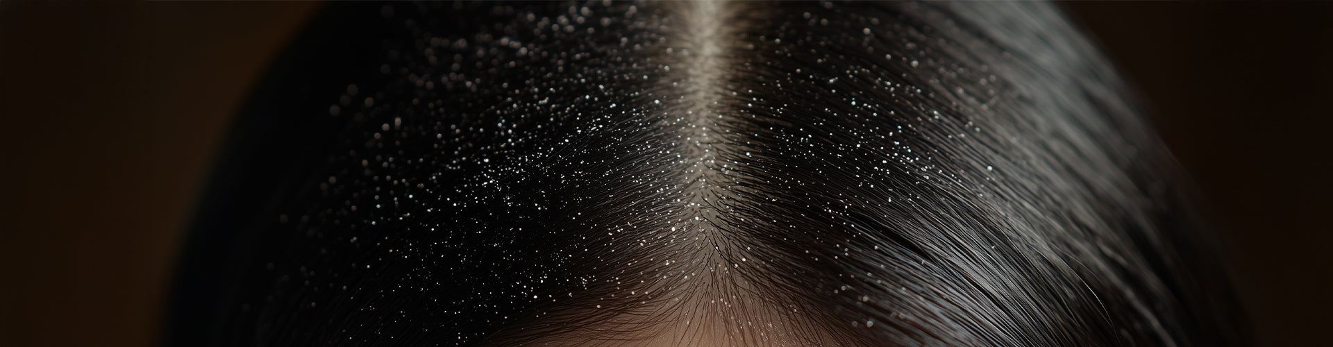 Shop by concern - Dandruff