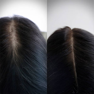 Beauty Garage ScalpSense Hydra Soothe Vaccine 15ml – Before & After results for scalp hydration & soothing care.