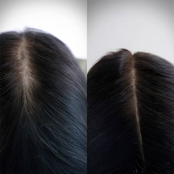 Beauty Garage ScalpSense Hydra Soothe Vaccine 15ml – Before & After results for scalp hydration & soothing care.