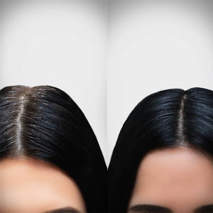 Beauty Garage ScalpSense Oil Out Vaccine 15ml – Before & After results for oil control & scalp purification.