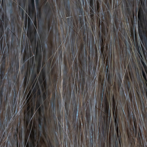 Illustration of dry, itchy, flaky scalp, highlighting irritation, dandruff, and the need for hydration and soothing care.