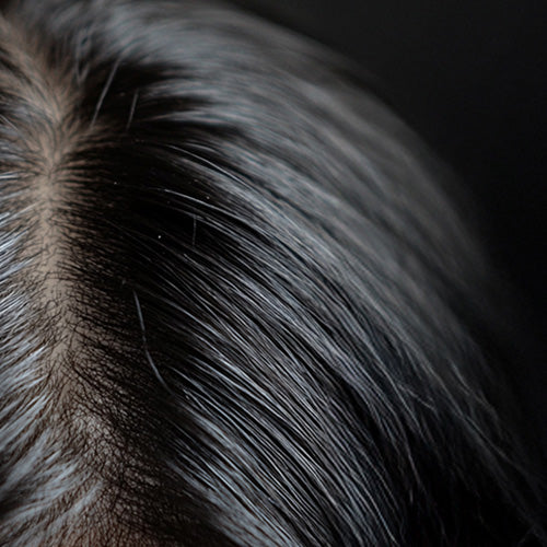 Illustration showing an oily scalp, highlighting excess sebum production and the need for balanced scalp care.